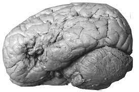 Brain